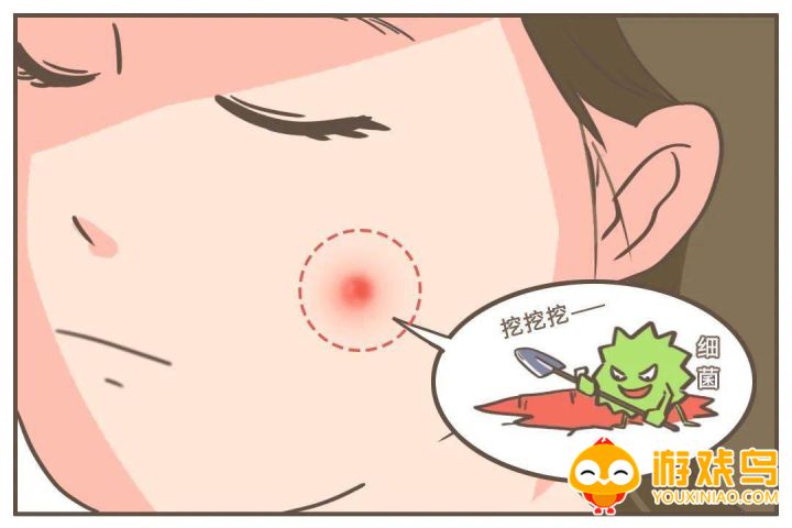 挤痘游戏合集
